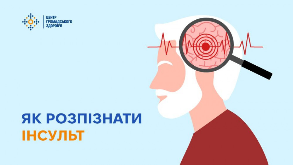 В Україні з початку року зареєстрували більше 96 тисяч випадків інсульту: як його визначити.