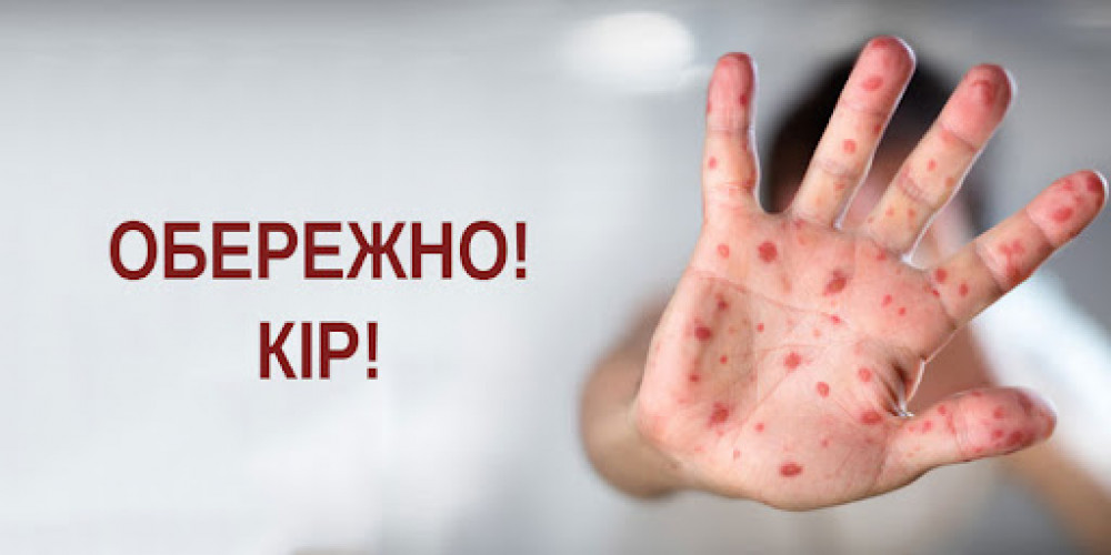 У населених пунктах Надвірнянського району через спалах кору можуть запровадити дистанційне навчання