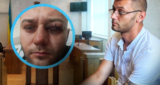 Ветеран з Франківщини, якого побили, відкликав заяву про злочин