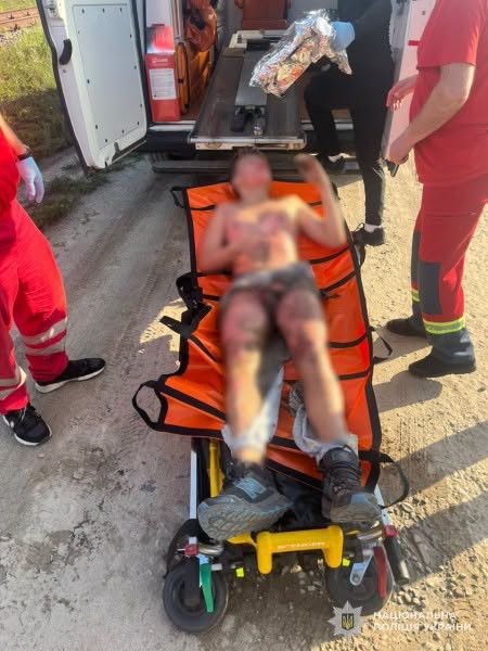 У Львові 13-річний хлопець отримав ураження електрострумом