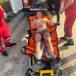 У Львові 13-річний хлопець отримав ураження електрострумом